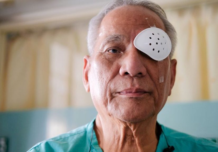 Glaucoma vs. Cataracts: Symptoms, Treatment, Impact on Vision