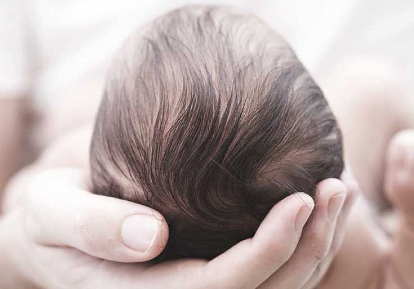 Chiari Malformation: Symptoms, Causes, and More