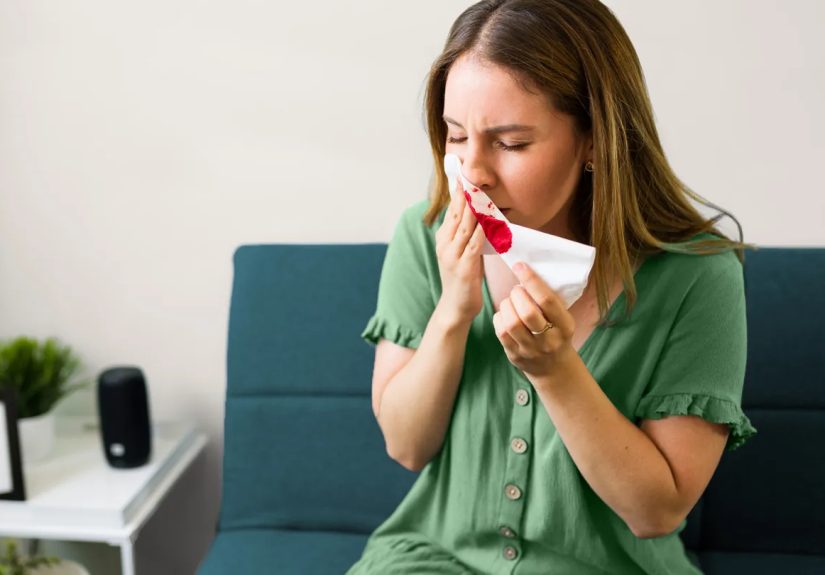 Here’s What Causes Nosebleeds and How to Stop Them