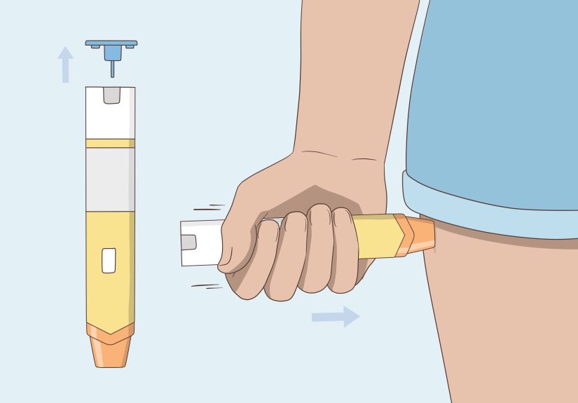 How to Treat Bee Sting Swelling: 10 Steps