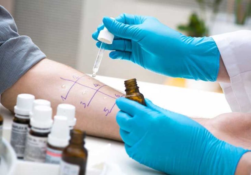 Insect Sting Allergy Tests: What You Need to Know
