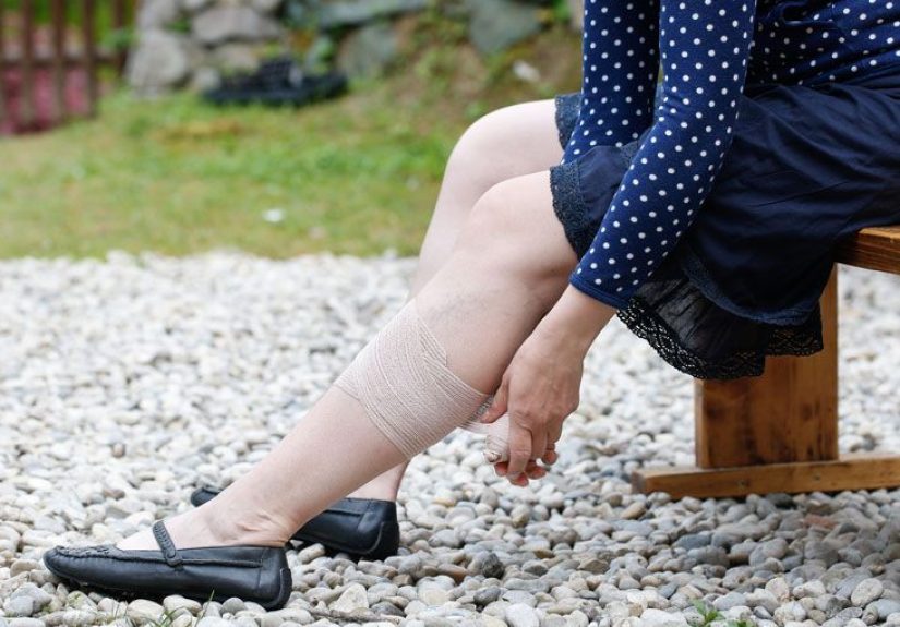Leg Ulcers: Causes, Diagnosis, and Treatments
