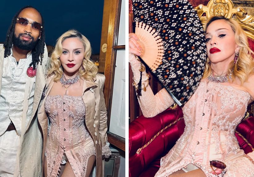 Madonna Hits Retirement Age And Reportedly Follows Her 29YO BF's Unexpected Cosmetic Change Advice
