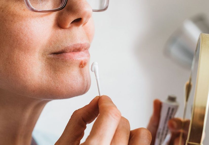 Raised Skin Bumps: Pictures, Types, Causes, and Treatment