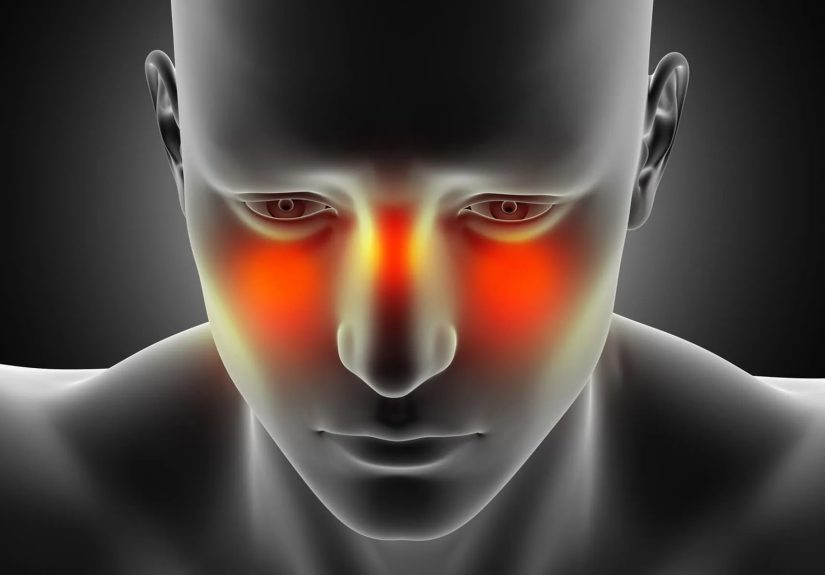 Reasons for Facial Pain