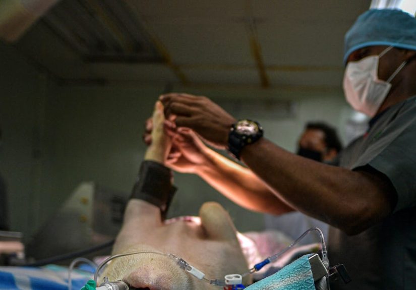 Surgeons Put a Pig Lung Inside a Human Body