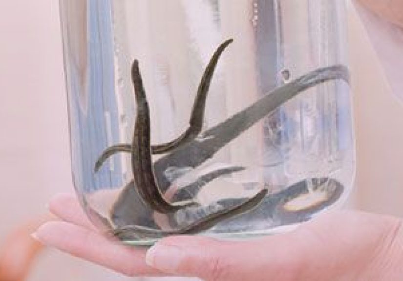 What Is Leech Therapy?