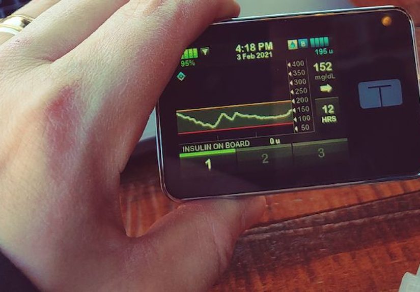 What to Do If Your Insulin Pump Malfunctions