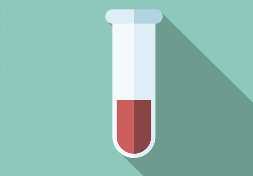 Blood Sodium Level Test: Purpose, Procedure, and Results