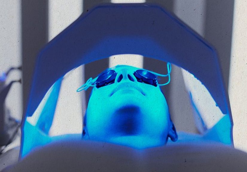 Blue light therapy for acne: Benefits, side effects, and costs