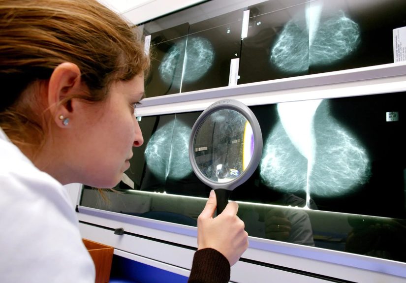 Common Chemicals: Breast Cancer Link?