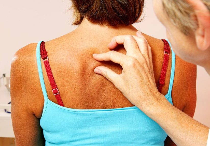 Cyst vs. Abscess: Knowing the Difference