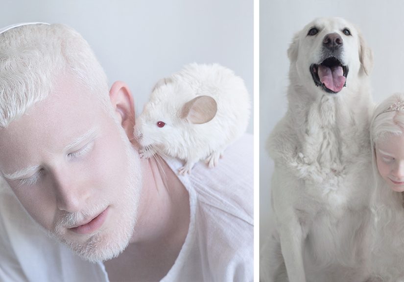 I Captured The Hypnotizing Beauty Of Albino People