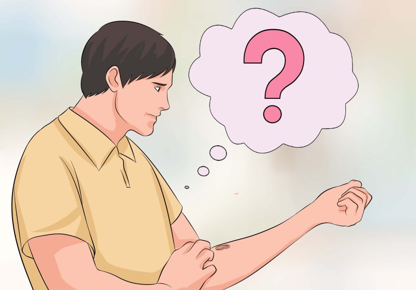 Is Your Compulsive Skin Picking A Disorder?