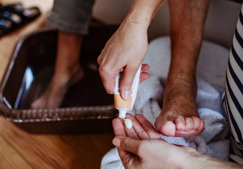 Nail Psoriasis Treatment Options