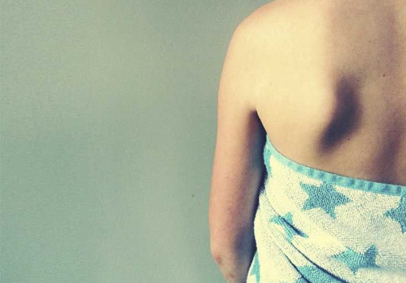 Pimple on the Nipple: Causes, Treatments, and More