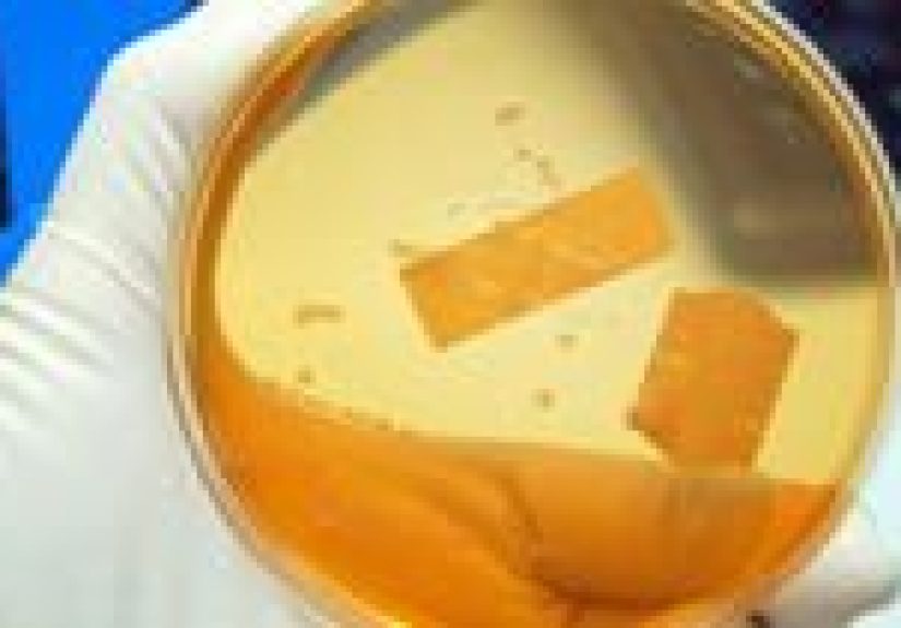 Salmonella Food Poisoning (Salmonella Enterocolitis)