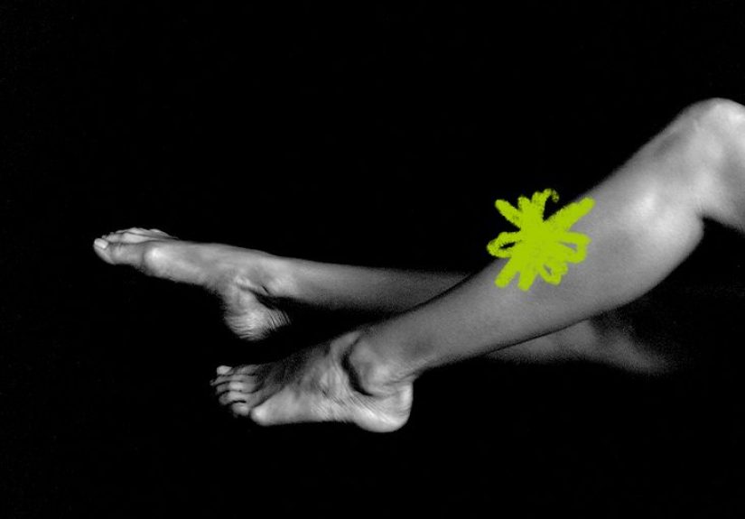 Soft tissue sarcoma in the leg: Symptoms and more