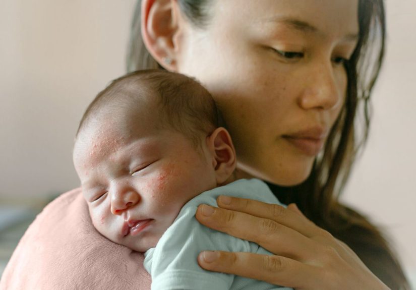 All About Baby Eczema: Causes, Symptoms, Treatment, and More