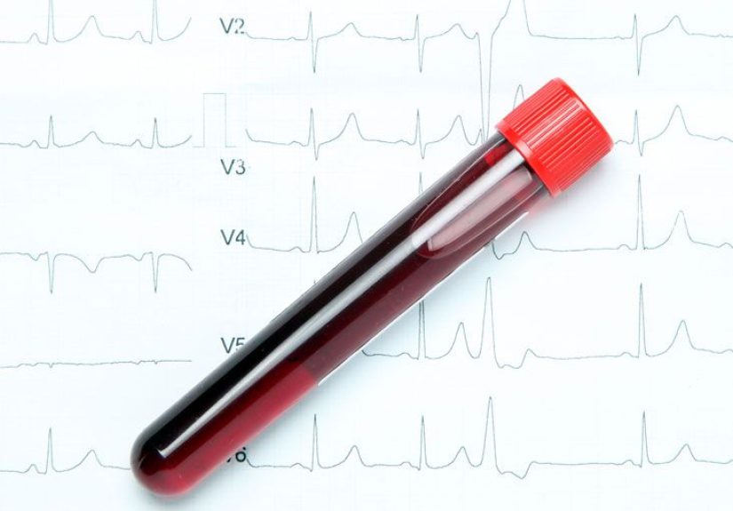 Leukocyte Alkaline Phosphatase: What Is It?