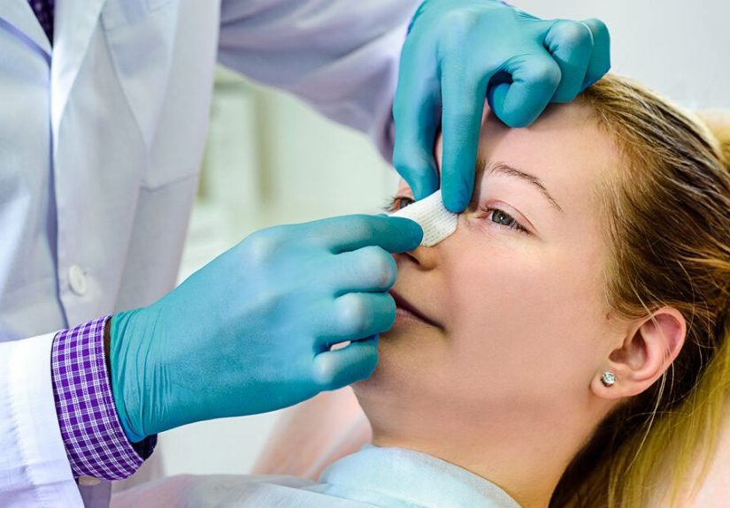 Nose Splints: How They Work, What To Expect, and More
