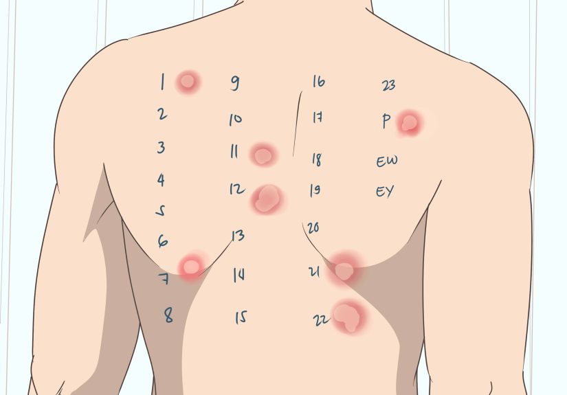 Safe and Effective Ways to Soothe Esophagus Pain