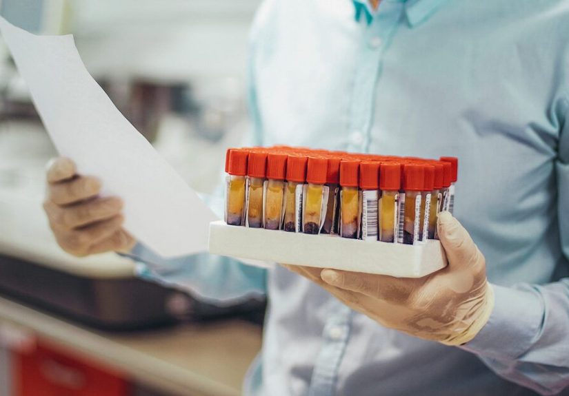 What To Do About Fluctuating Liver Enzyme Levels