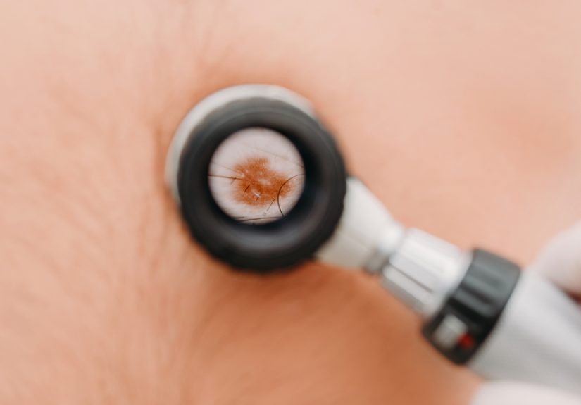 It’s Time for Teamwork in Dermatology