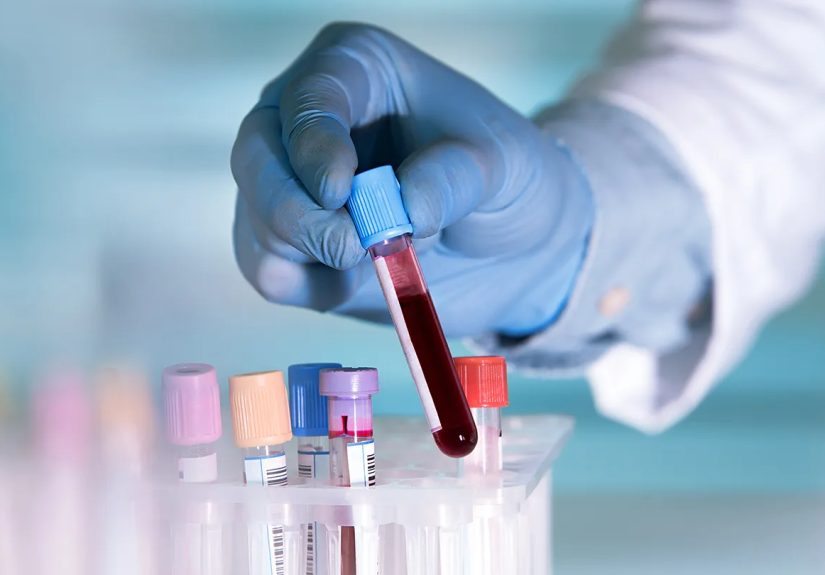 Liquid Biopsy for Lung Cancer: Types, Uses, and Risks
