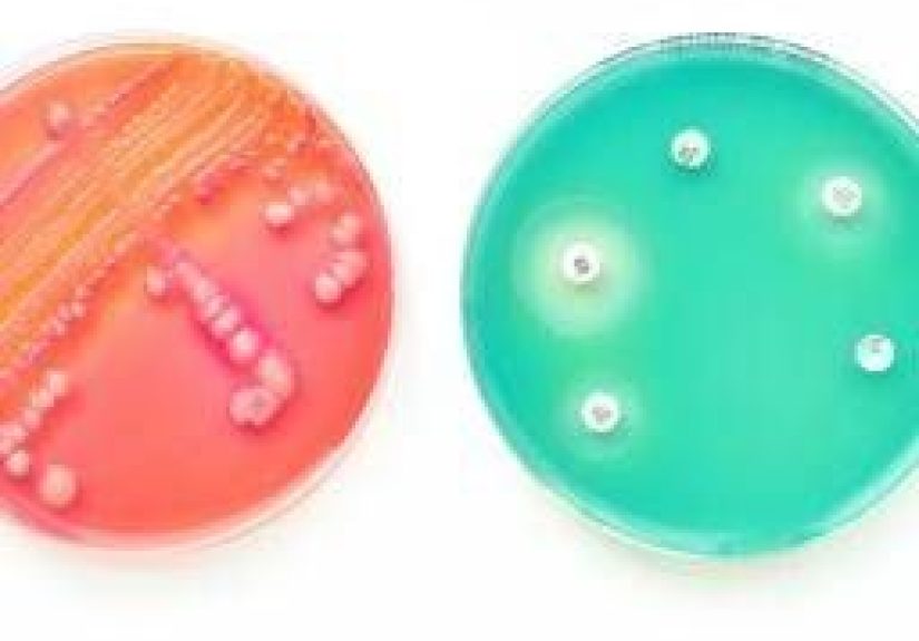 Loss of Microbial Gut Diversity a Threat to Health?