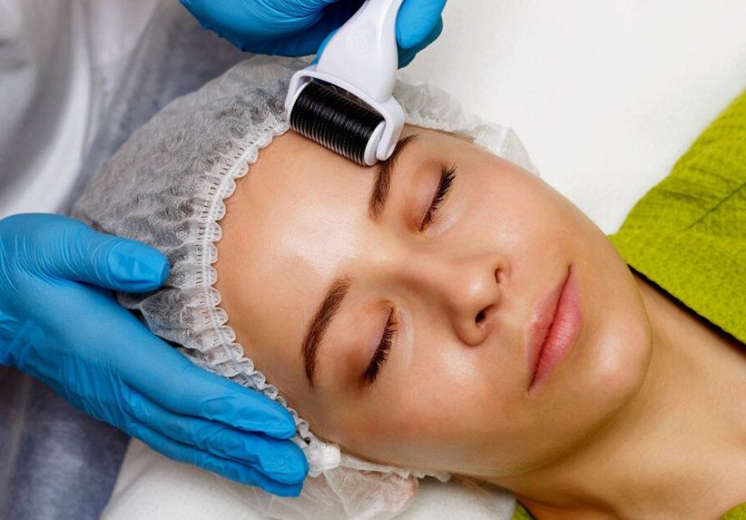 Microneedling Cost by Type and Body Part, Versus Laser, and More
