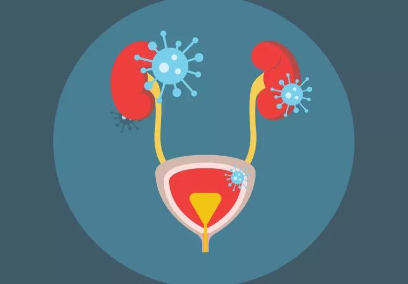 Urinary Tract Health, From Bladder to Kidney Infections