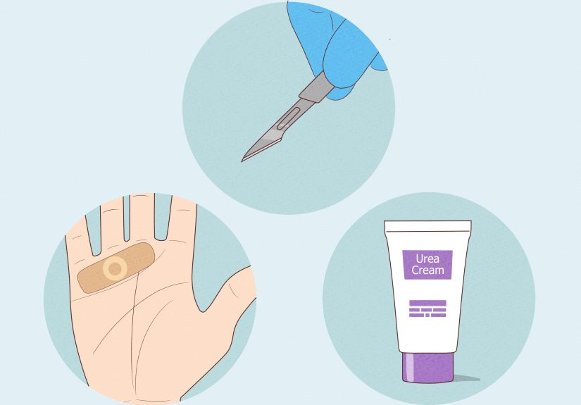 What Do Calluses on Heart Line in Hand Mean? Complete Guide